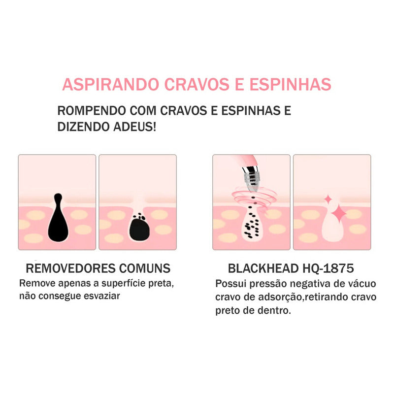 Extractor de puntos negros y limpiador de succión + esponijlla silicona (obsequio)