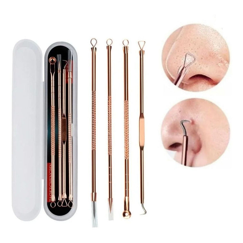 Extractor de Puntos Negros y Espinillas - Kit Manual de 4 Piezas